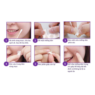 Combo 5 Miếng Dán hỗ trợ điều trị Mụn Mayancare 20 Miếng (0.8cm)