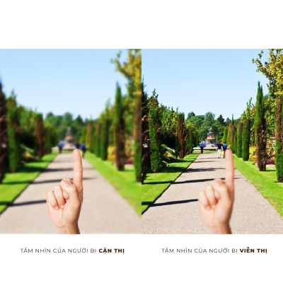 Kính áp tròng viễn thị trong suốt COSMO | Angel Eyes Contact Lens | Độ viễn +0.50 đến +6.00 (Có hỗ trợ viến lệch)