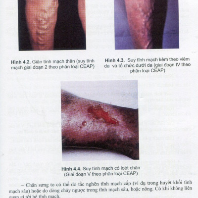 Sách - Bệnh học Nội khoa 2023 (Tập 2)