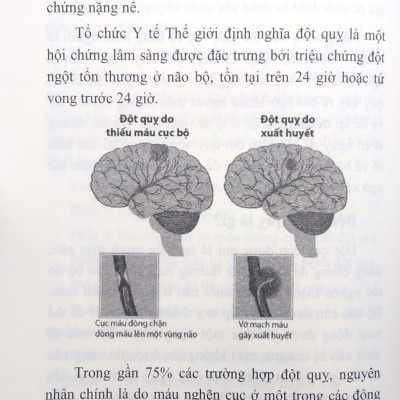 Bệnh Đột Quỵ Và Cách Điều Trị