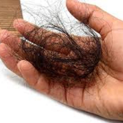 TINH DẦU BƯỞI NGUYÊN CHẤT MẸ KEN-Chai 100ml