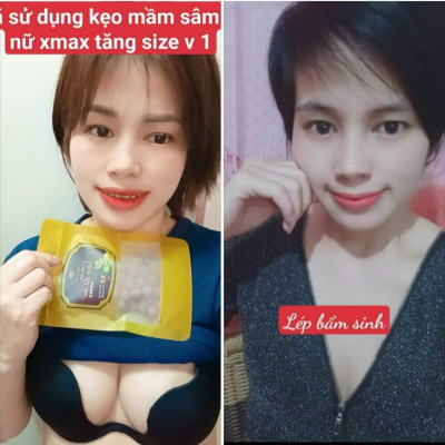 5h kẹo mầm sâm tố nữ xmax Mychi