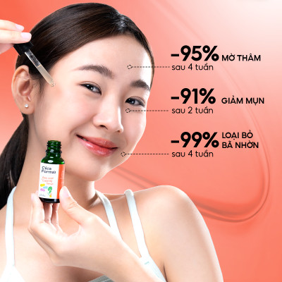 Serum rau má giảm mụn Oribe dịu nhẹ giúp mờ thâm phục hồi da hỗ trợ kiềm dầu 20ml