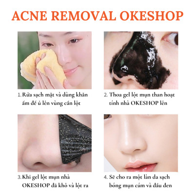 Gel Lột Mụn Than Tre Hoạt Tính OKESHOP 30ml - Giải Pháp Loại Bỏ Mụn Đầu Đen - Mụn Cám - Bạ Nhờn - Làm Sạch Sâu Và Thu Nhỏ Lỗ Chân Lông