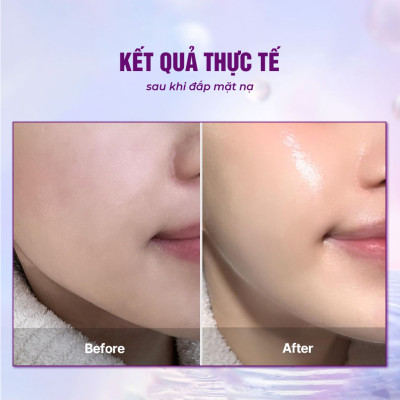 Combo 3 Mặt nạ sinh học BESKINATY Hydro Bio Mask cấp ẩm chuyên sâu cho da Hàn Quốc
