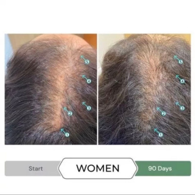 Dầu xả chống oxy hóa, kích thích mọc tóc REVITA.CBD CONDITIONER  205ML