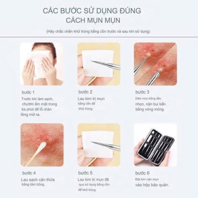 Sét Dụng Cụ Nặn Mụn JPNK Pro Hàng chính hãng