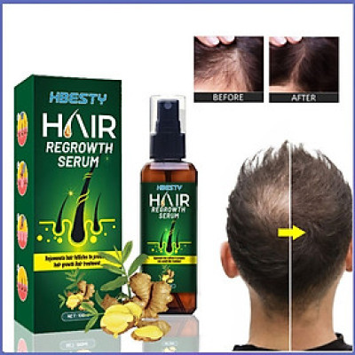Serum dưỡng mọc tóc, giúp tóc mọc nhanh, nhiều và dày, sợi tóc đen bóng xuất xứ Nhật Bản – Mã số 1230