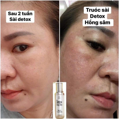 Detox Hồng Sâm Dr Cell 50ml thải độc tố da hỗ trợ giảm mụn hỗ trợ mờ thâm nám - Hàng Chính Hãng