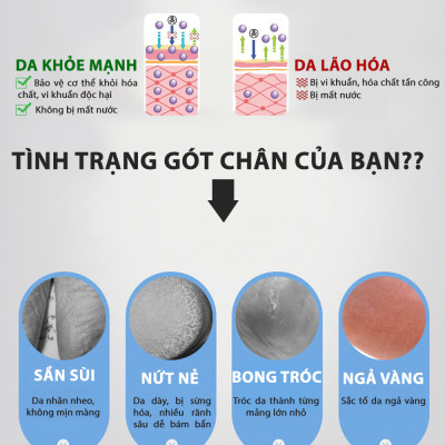 Combo 5 cặp vớ bọc gót chân silicone chống nứt nẻ chống bong tróc da và giúp làm hồng gót sen - buybox - BBPK68_5