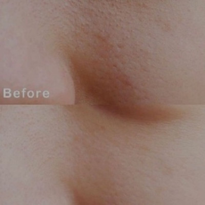 Nước Hoa Hồng Se Khít Lỗ Chân Lông Chiết Xuất Sữa Ong Chúa Dr.Ci:Labo Supper Keana Lotion (2 Size)